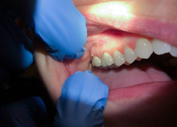 Best After-Hours Emergency Dentist in Hector, MN